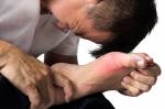 Điều trị bệnh Gout ngay tại nhà như thế nào?