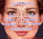 Bài thuốc hay trị viêm xoang